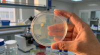 World Parasitology Culture Media - Market Analysis, Forecast, Size, Trends and Insights