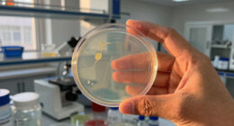 World Parasitology Culture Media - Market Analysis, Forecast, Size, Trends and Insights